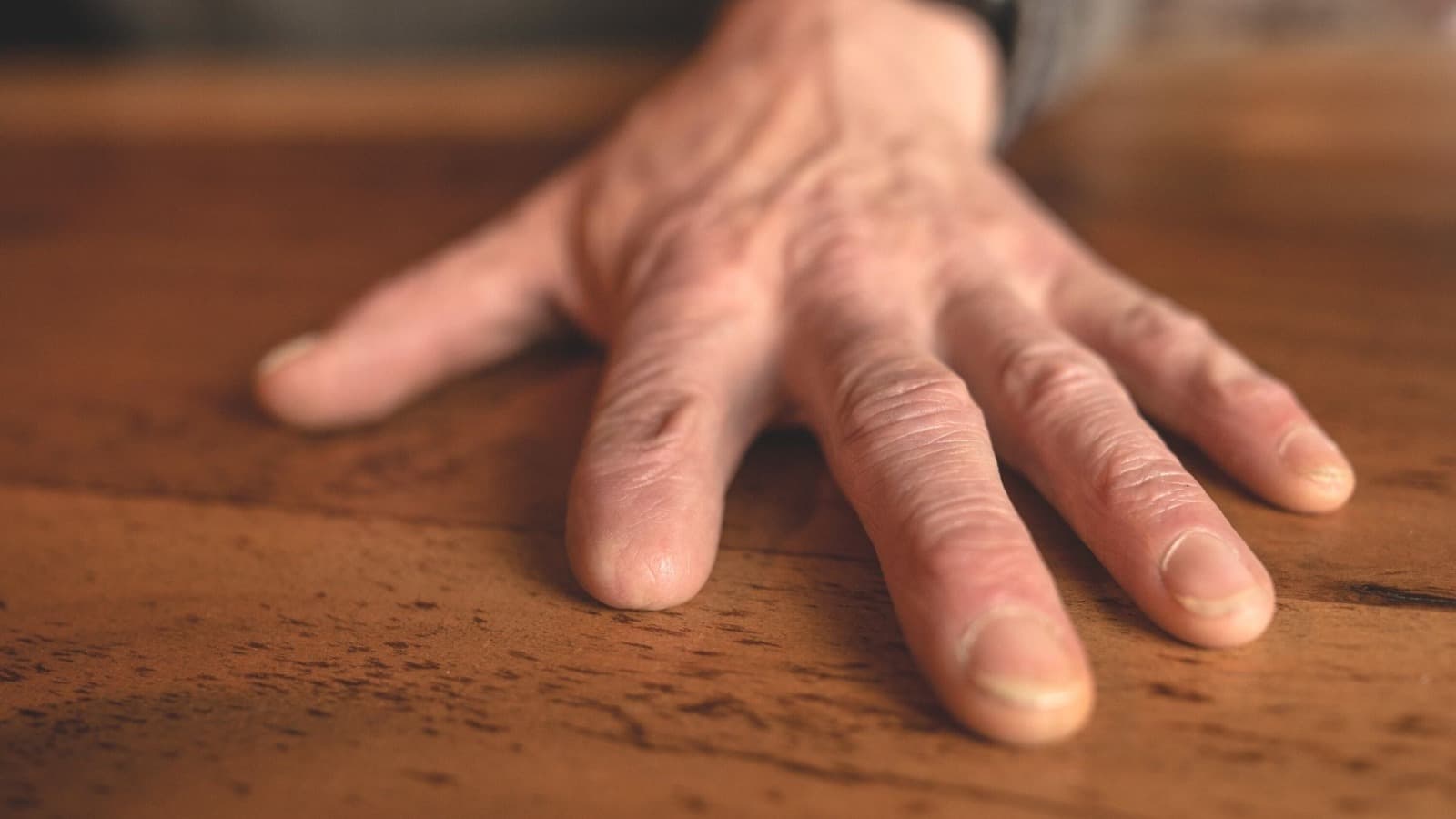 Imagem de fundo para Auxílio-Acidente